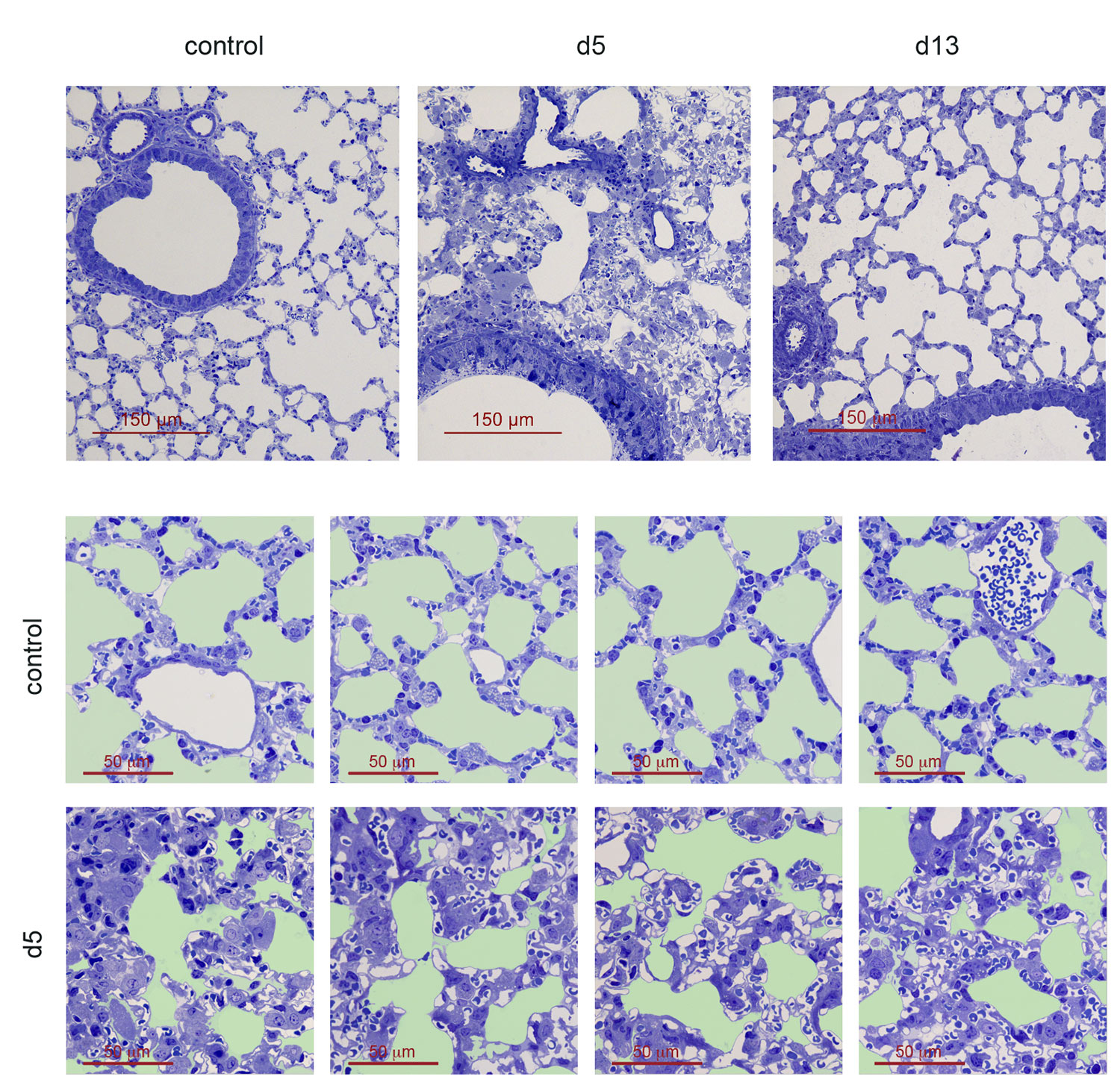 Lung semi-thin sections showing the alveolar disorganization, resulting from pneumocyte hypertrophy, occuring at day 5 after induction of HDM airway allergy. Alveolar organization was restored at day 13 of HDM-induced allergy (Feo-Lucas et al., Frontiers in Immunology 2023).