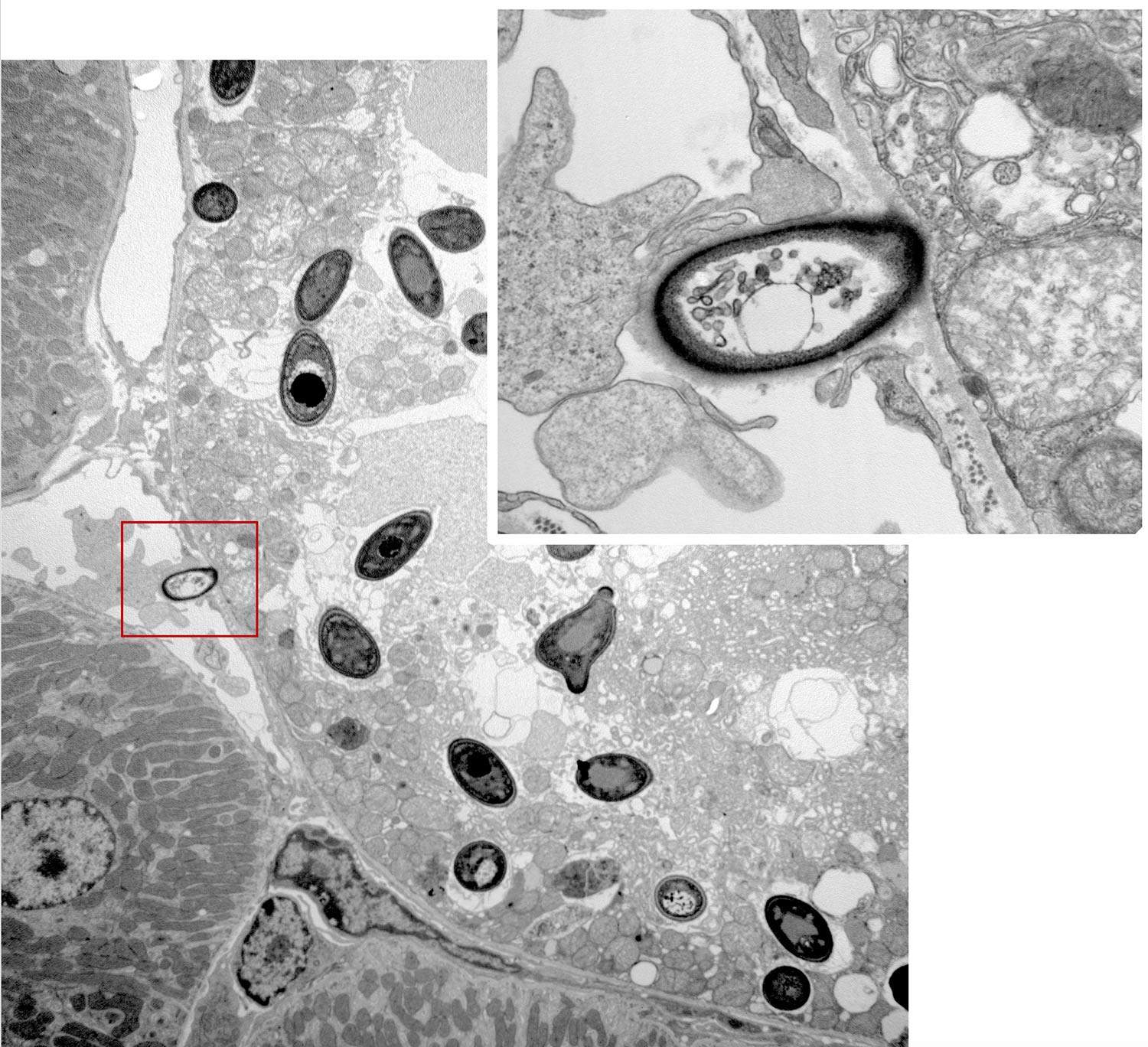 Electron microscopy imaging of the kidney at 60 minutes after systemic Candida albicans infection showing a renal tubule invaded by Candida yeasts. Insert: high magnificaction of the area marked in red, showing a Candida yeast invading the renal epithelium from a blood capillary.