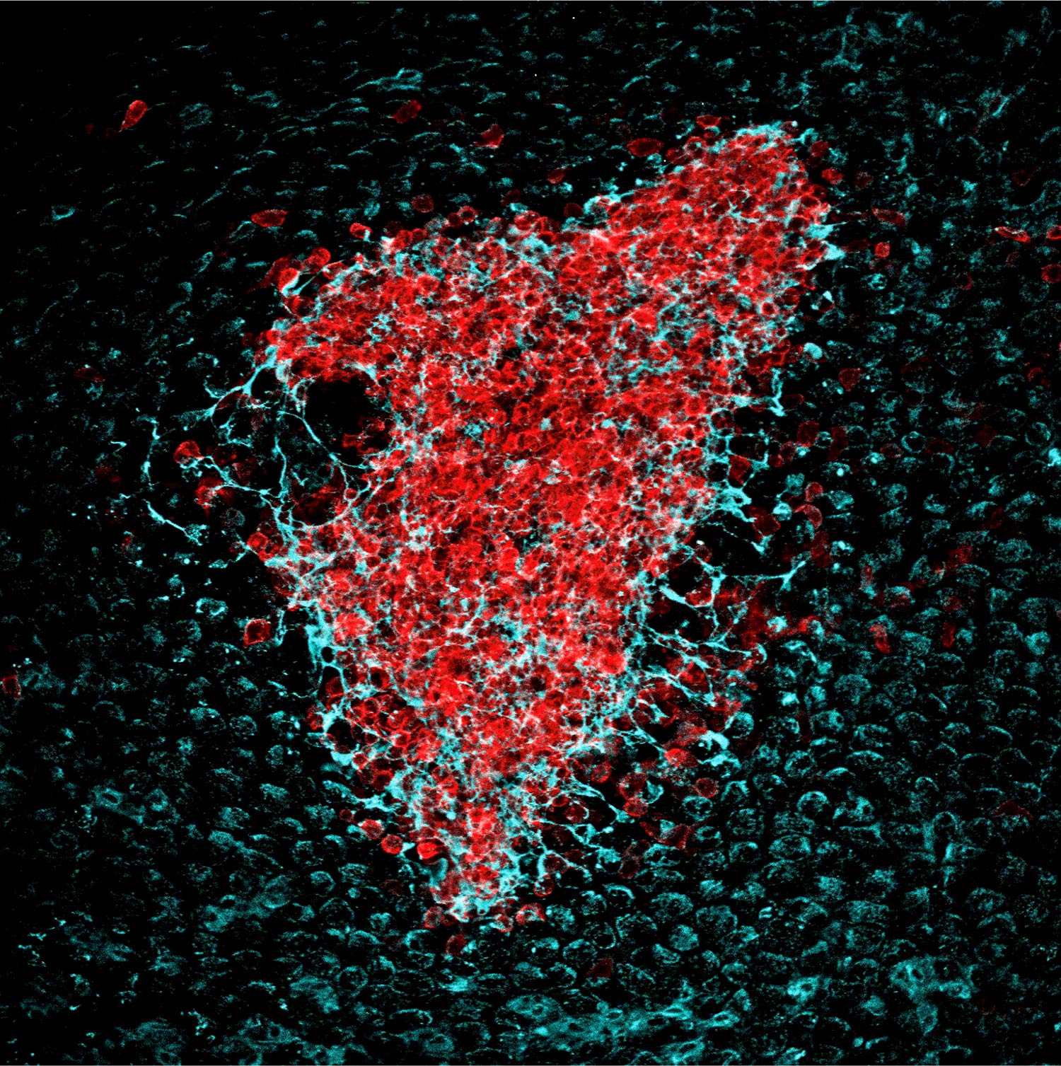 Imaging of the peritoneal wall by whole mount immunofluorescence combined with confocal microscopy, at 4 hours after intraperitoneal Escherichia coli infection, showing a resMØ-aggregate harboring a developed fibrin nerwork. Red: F4/80, peritoneal macrophages; blue: fibrinogen (Vega-Pérez et al., Immunity 2021).