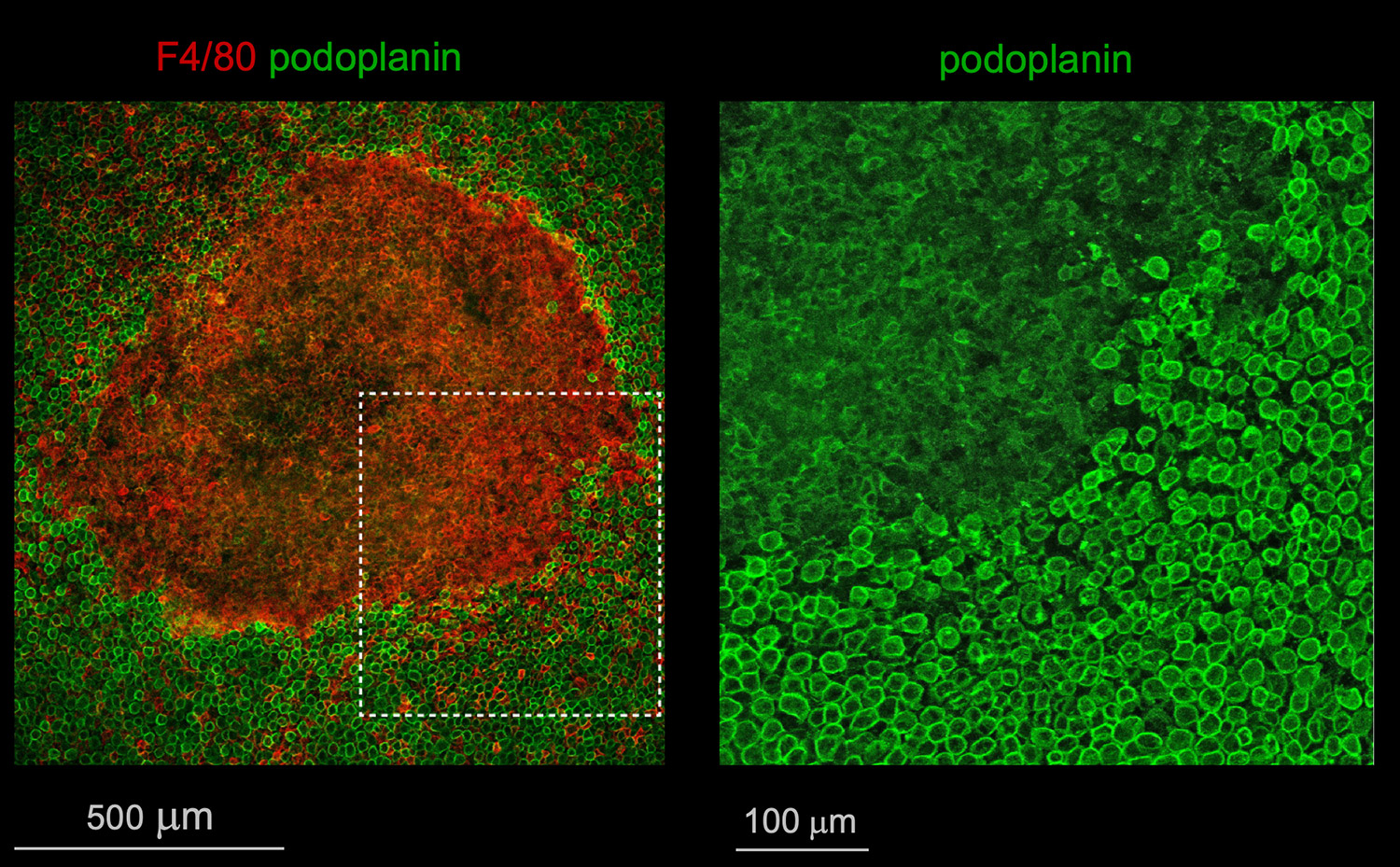 resMØ-aggregate in the peritoneal wall, at 4 hours after intraperitoneal Escherichia coli infection. Right panel: enlargement of the area marked in the left panel, showing the disorganization of the mesothelium underneath the resMØ-aggregate. Red: F4/80, peritoneal macrophages; green: podoplanin, mesothelial cells (Vega-Pérez et al., Immunity 2021).