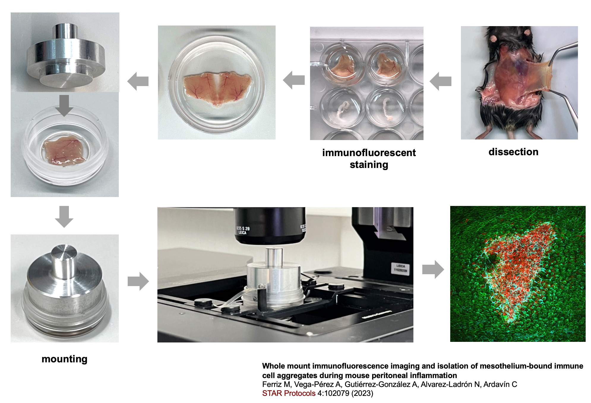 Protocol for whole immunofluorescene and confocal microscopy imaging of the peritoneal wall and omentum (Ferriz et al., STAR Protocols 2023).